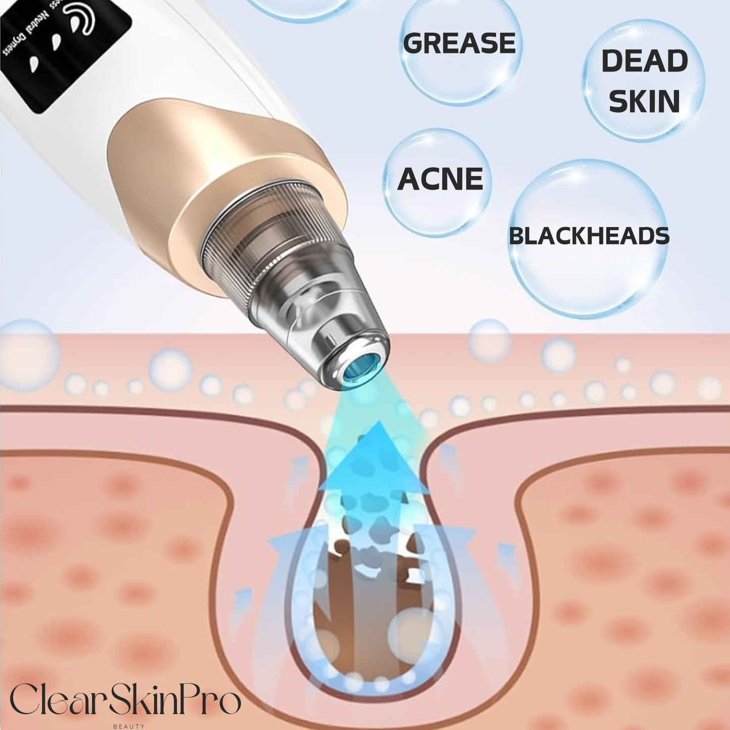 ClearSkin Pro™ - Blackhead Pore Vacuum