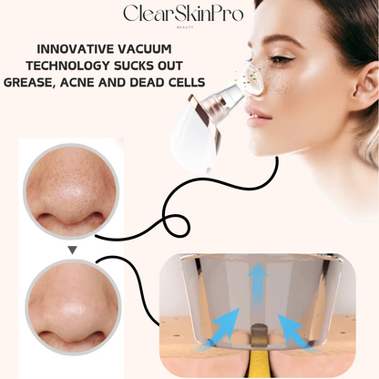 ClearSkin Pro™ - Blackhead Pore Vacuum