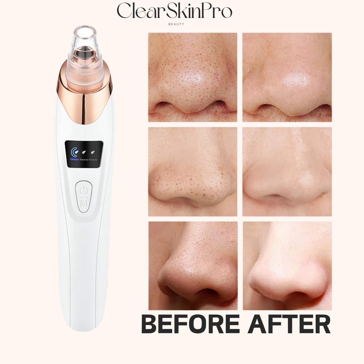 ClearSkin Pro™ - Blackhead Pore Vacuum