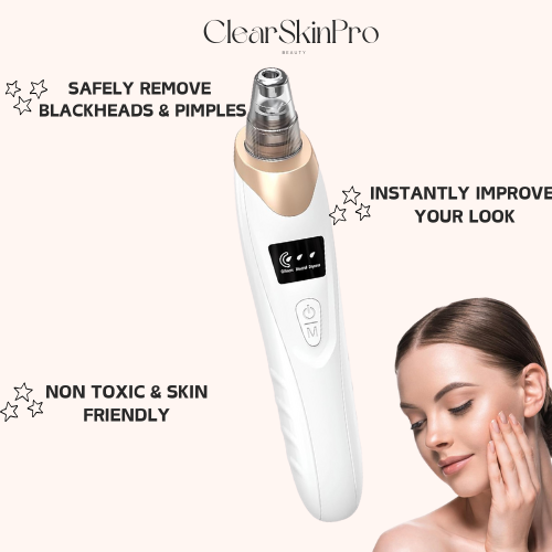 ClearSkin Pro™ - Blackhead Pore Vacuum